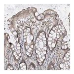 Atlas Antibodies Anti-PPA2 Antibody