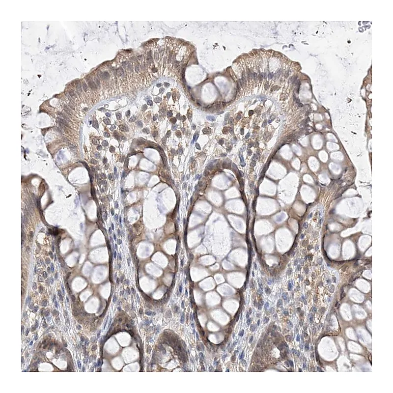 Atlas Antibodies Anti-PPA2 Antibody