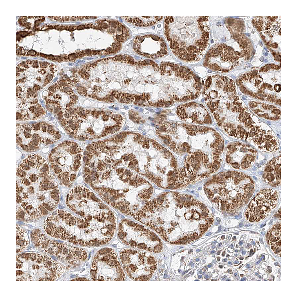 Atlas Antibodies Anti-PPA2 Antibody