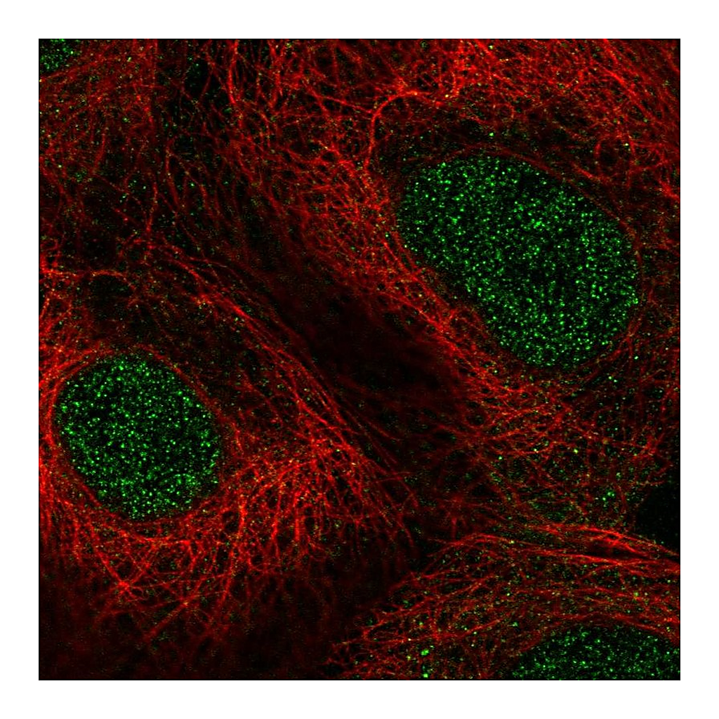 Atlas Antibodies Anti-PPARA Antibody