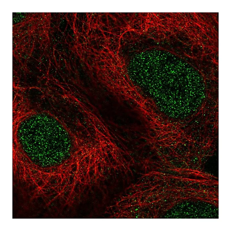 Atlas Antibodies Anti-PPARA Antibody