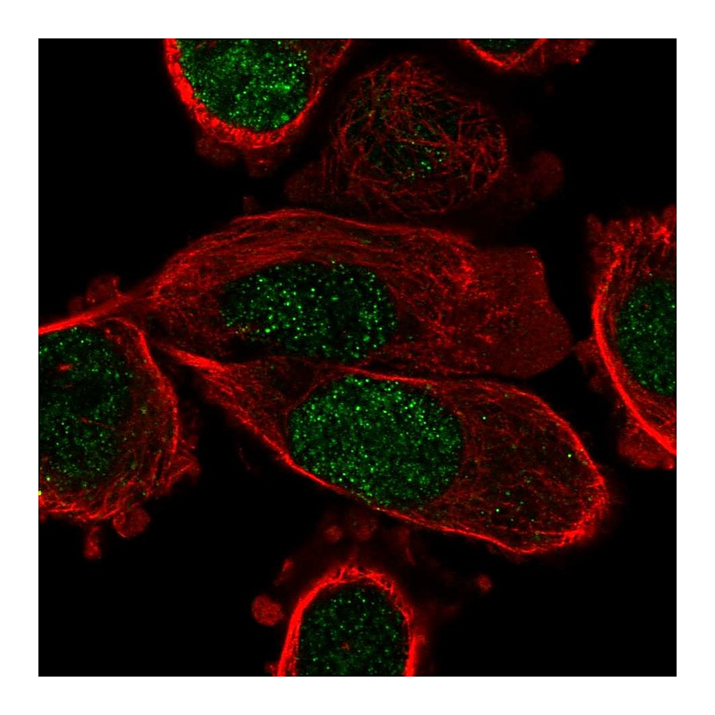 Atlas Antibodies Anti-PPARG Antibody