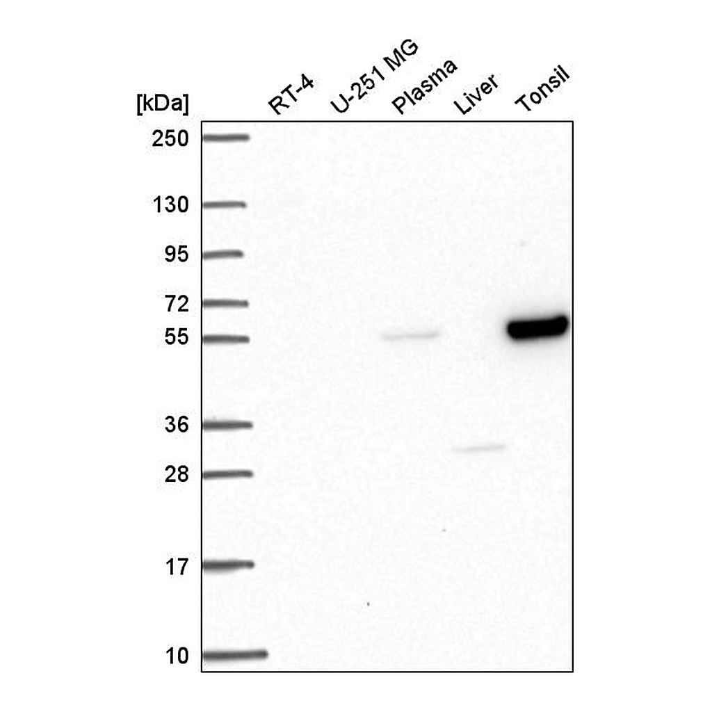 Atlas Antibodies Anti-PPARA Antibody