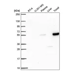 Atlas Antibodies Anti-PPARA Antibody