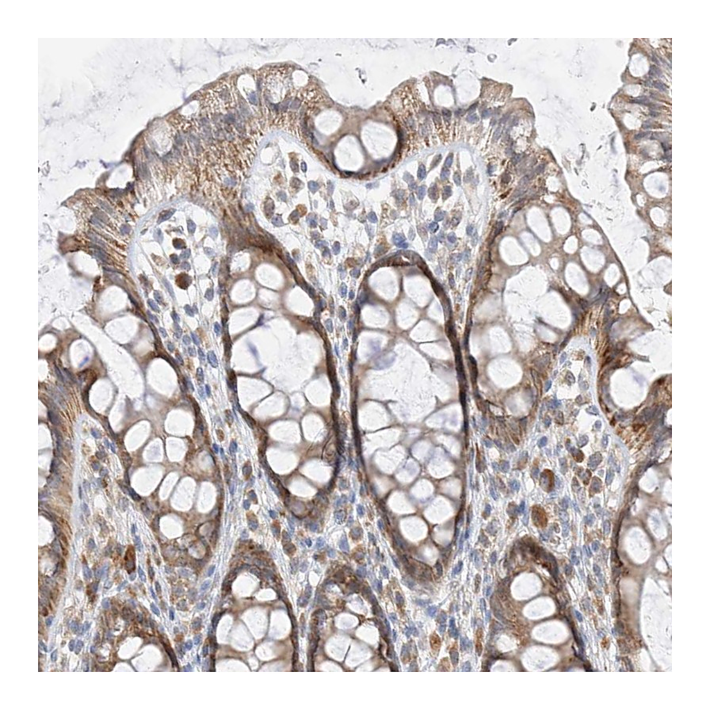 Atlas Antibodies Anti-PPA2 Antibody