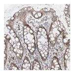 Atlas Antibodies Anti-PPA2 Antibody