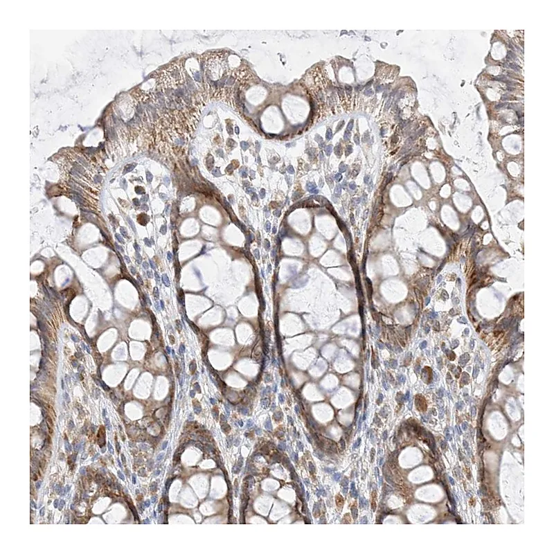 Atlas Antibodies Anti-PPA2 Antibody
