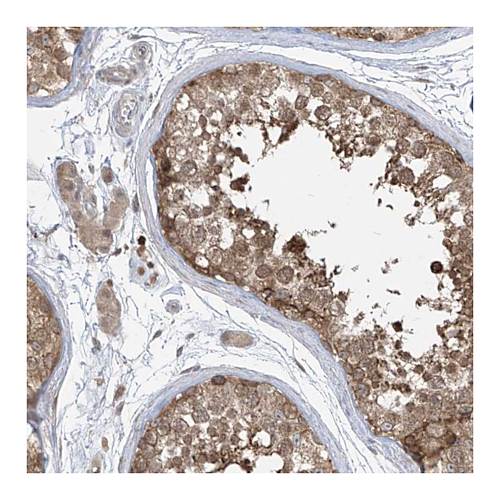 Atlas Antibodies Anti-PPAT Antibody