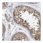 Atlas Antibodies Anti-PPAT Antibody