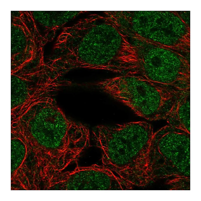 Atlas Antibodies Anti-PPARGC1B Antibody