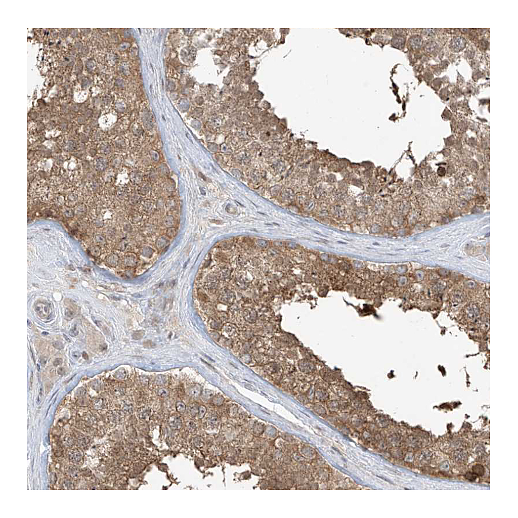 Atlas Antibodies Anti-PPAT Antibody