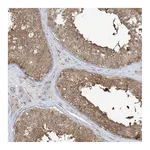 Atlas Antibodies Anti-PPAT Antibody