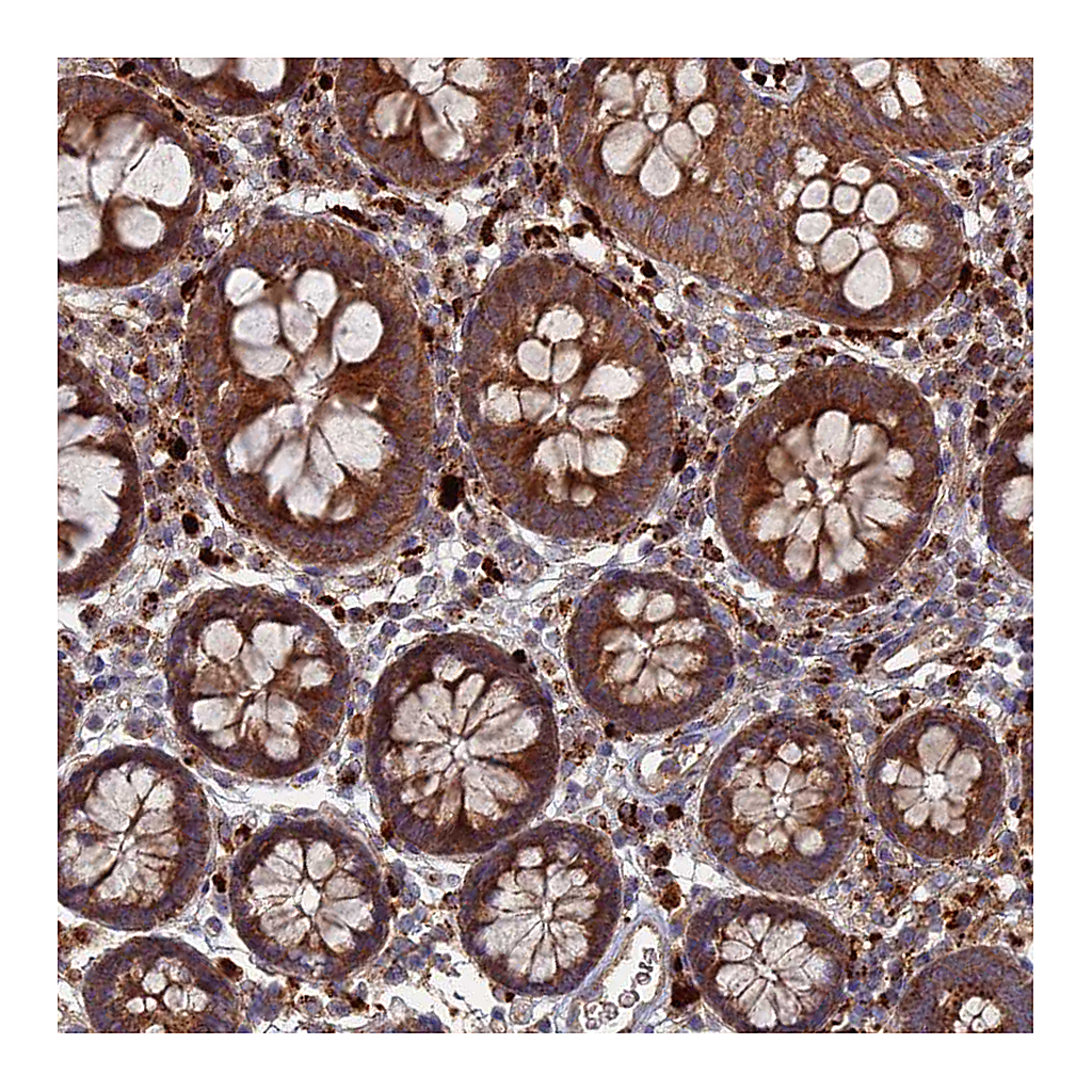Atlas Antibodies Anti-PPCDC Antibody