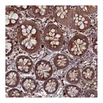 Atlas Antibodies Anti-PPCDC Antibody