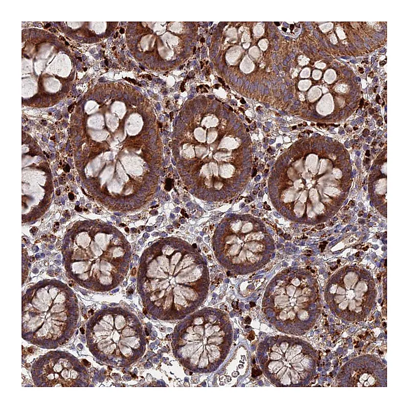 Atlas Antibodies Anti-PPCDC Antibody