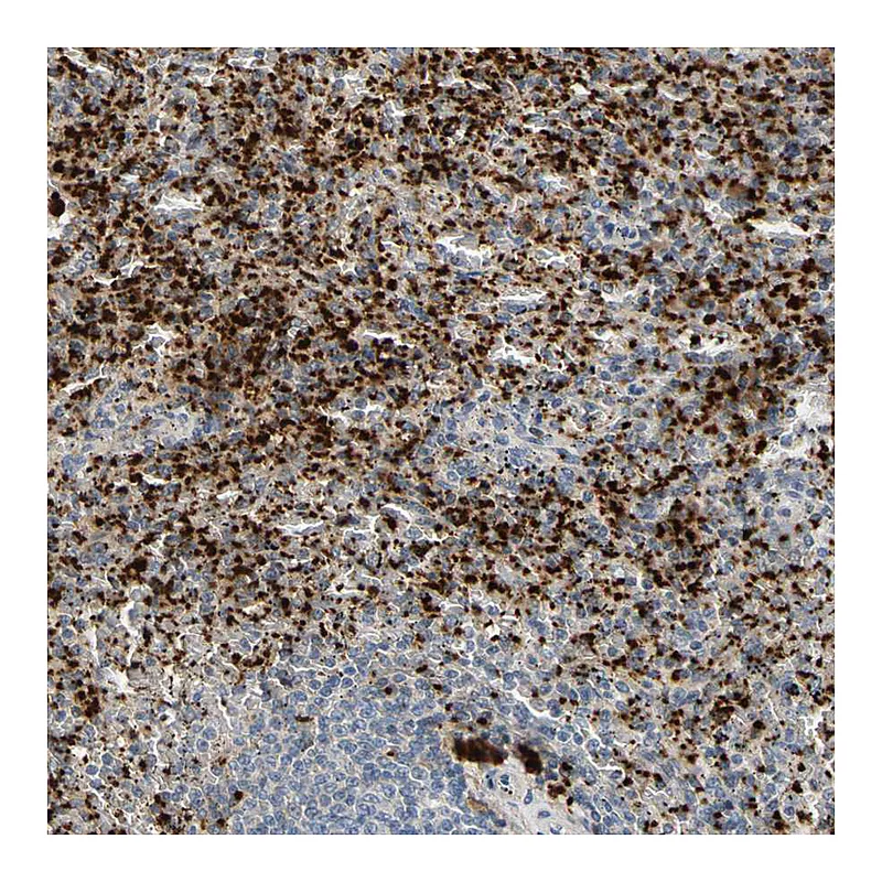 Atlas Antibodies Anti-PPBP Antibody