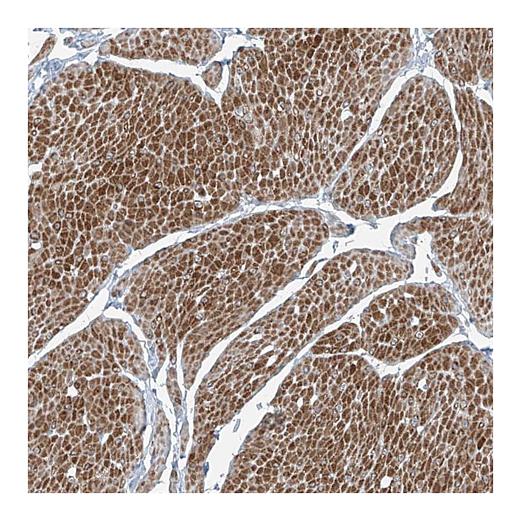 Atlas Antibodies Anti-PPCS Antibody