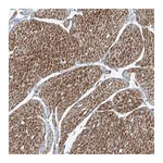 Atlas Antibodies Anti-PPCS Antibody