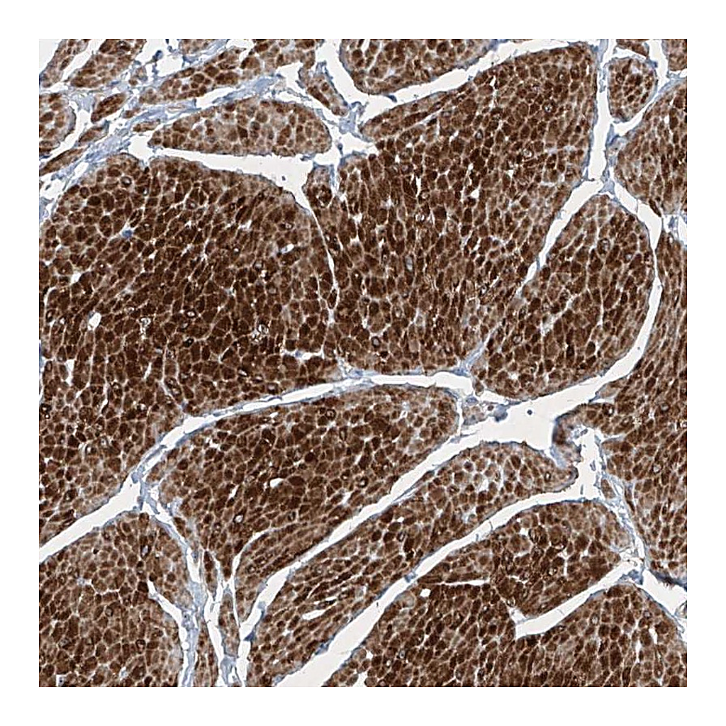 Atlas Antibodies Anti-PPCS Antibody