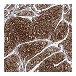 Atlas Antibodies Anti-PPCS Antibody