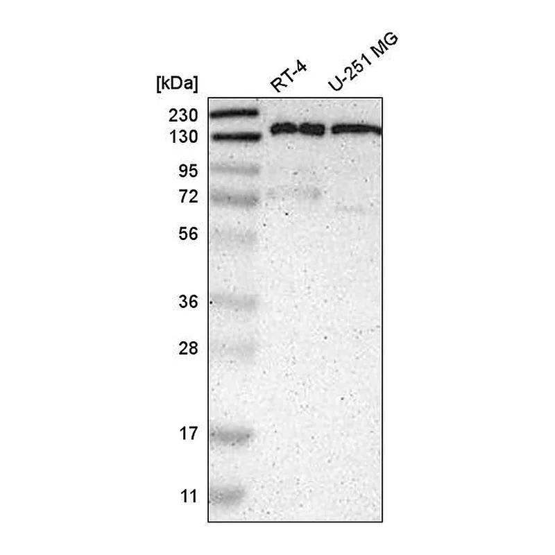 Atlas Antibodies Anti-PPFIA1 Antibody