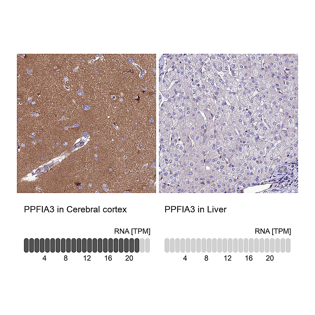 Atlas Antibodies Anti-PPFIA3 Antibody