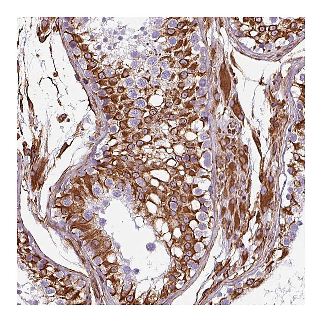 Atlas Antibodies Anti-PPFIA1 Antibody