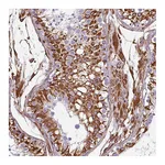 Atlas Antibodies Anti-PPFIA1 Antibody