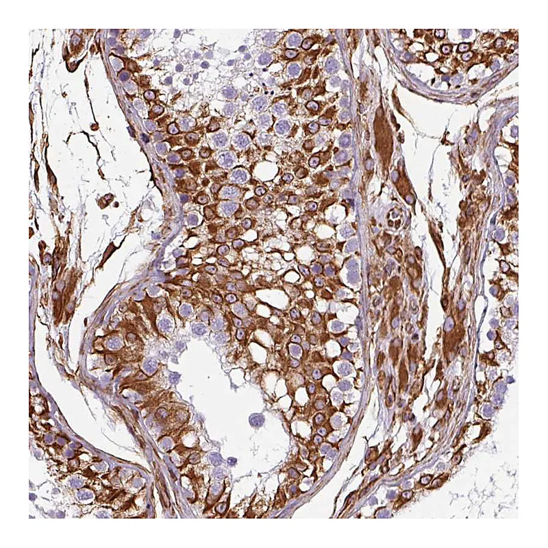 Atlas Antibodies Anti-PPFIA1 Antibody