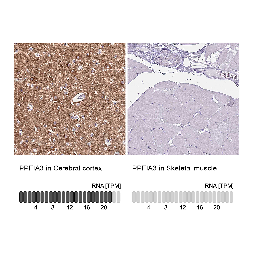 Atlas Antibodies Anti-PPFIA3 Antibody