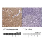 Atlas Antibodies Anti-PPFIA4 Antibody