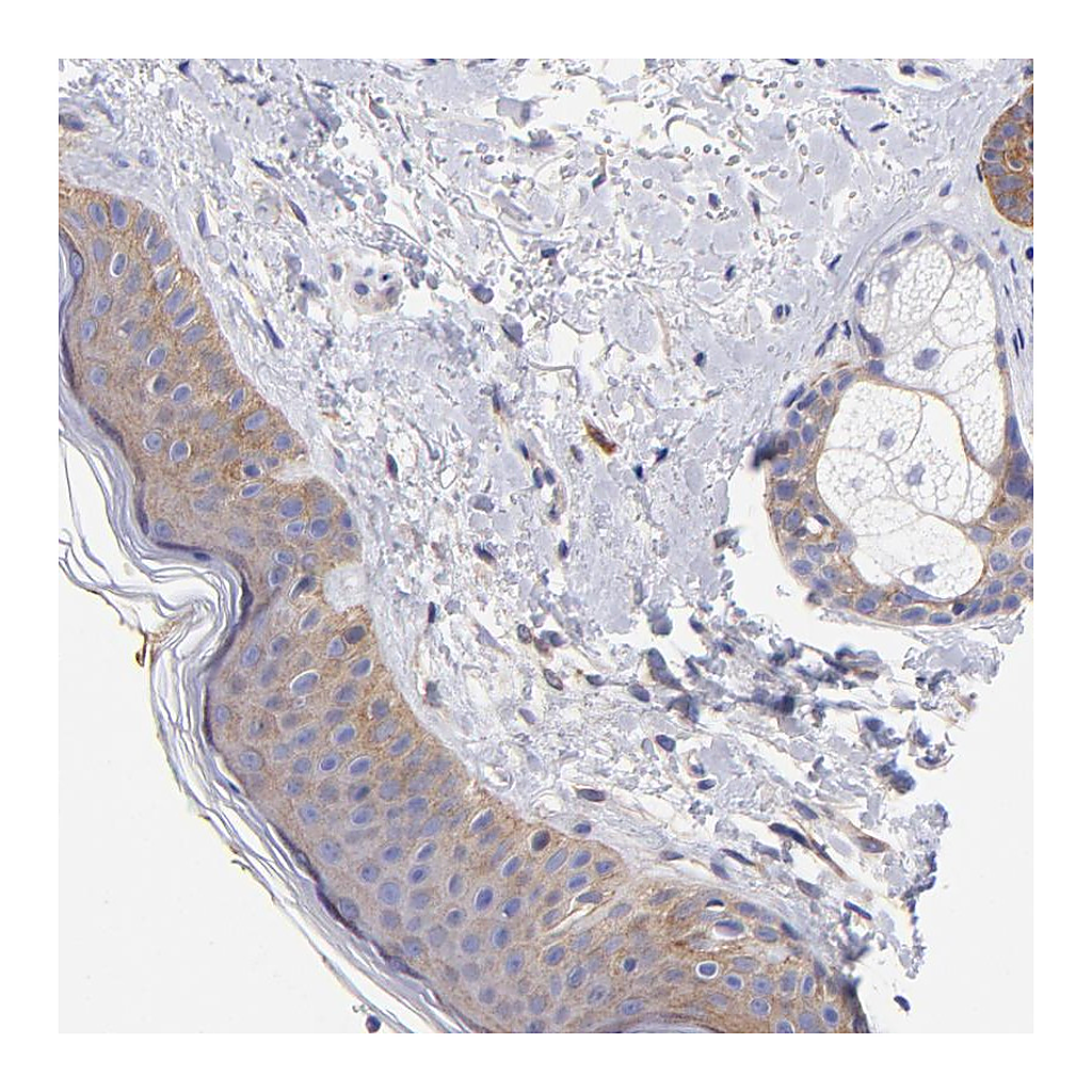 Atlas Antibodies Anti-PPFIBP1 Antibody