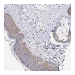 Atlas Antibodies Anti-PPFIBP1 Antibody