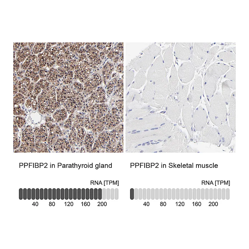 Atlas Antibodies Anti-PPFIBP2 Antibody
