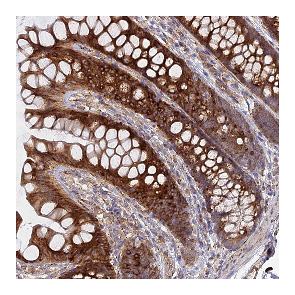 Atlas Antibodies Anti-PPIC Antibody