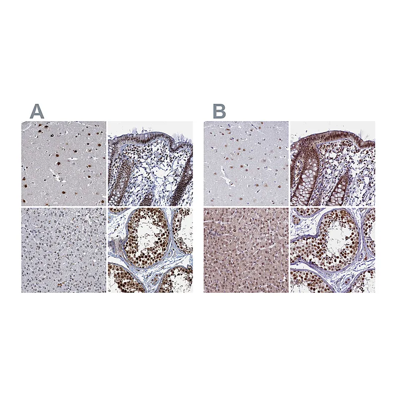 Atlas Antibodies Anti-PPHLN1 Antibody