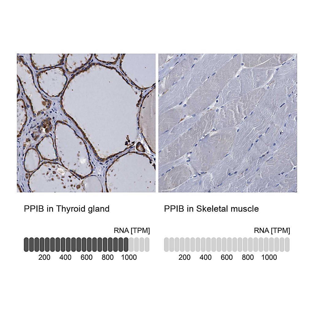 Atlas Antibodies Anti-PPIB Antibody