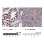 Atlas Antibodies Anti-PPHLN1 Antibody