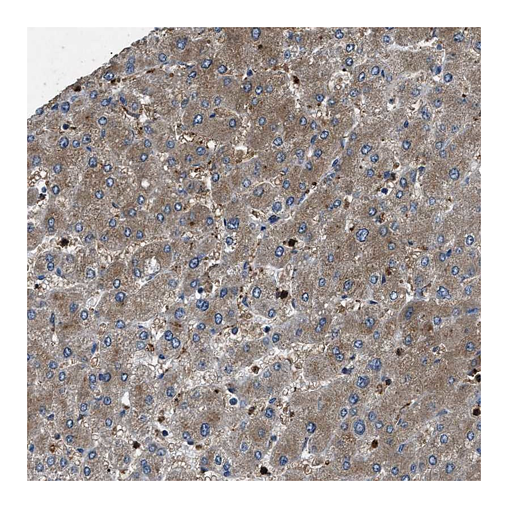 Atlas Antibodies Anti-PPID Antibody