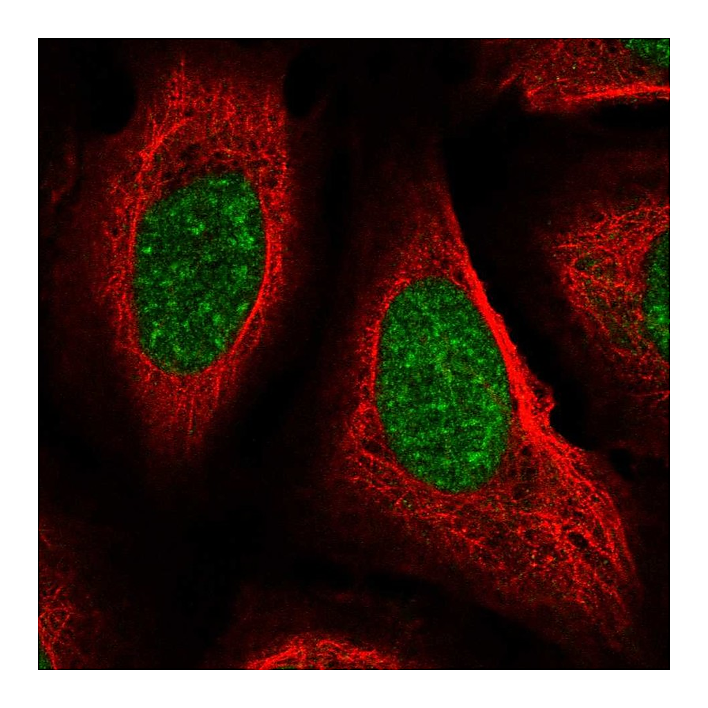 Atlas Antibodies Anti-PPIE Antibody