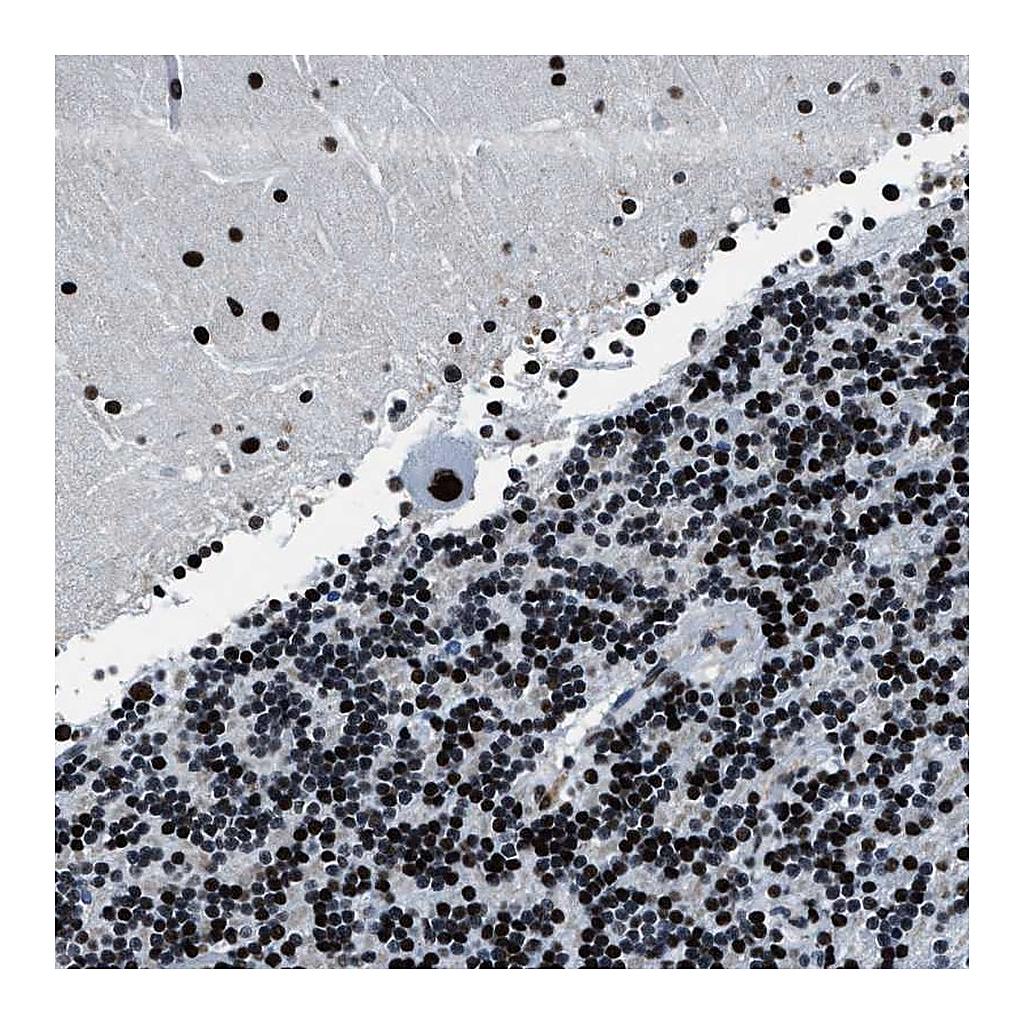 Atlas Antibodies Anti-PPIE Antibody