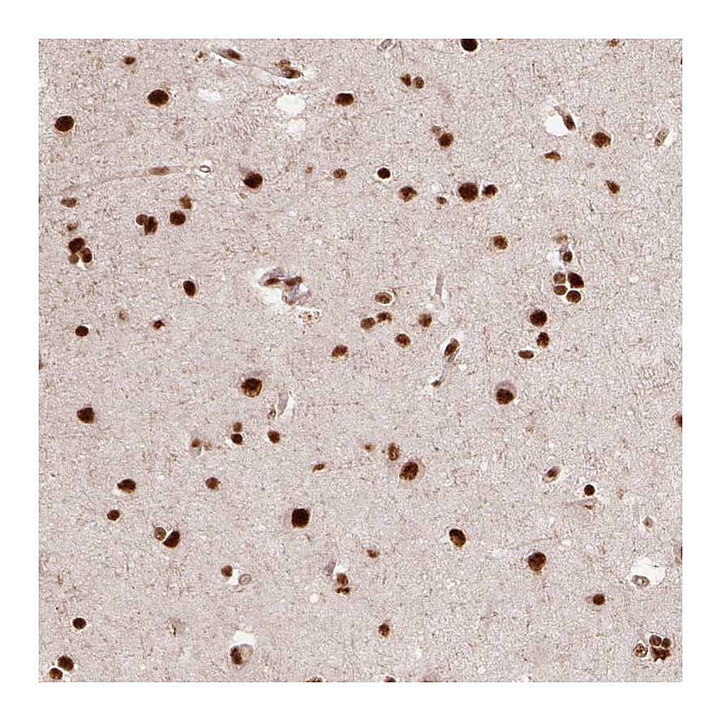 Atlas Antibodies Anti-PPIG Antibody