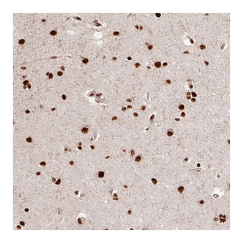 Atlas Antibodies Anti-PPIG Antibody