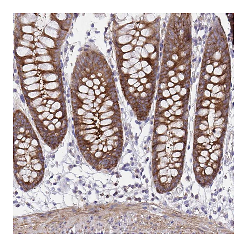 Atlas Antibodies Anti-PPIH Antibody