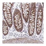 Atlas Antibodies Anti-PPIH Antibody