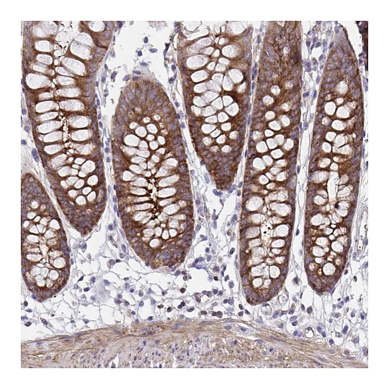 Atlas Antibodies Anti-PPIH Antibody