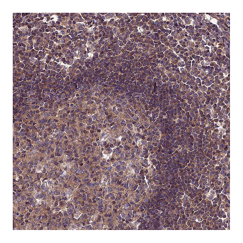 Atlas Antibodies Anti-PPIL3 Antibody