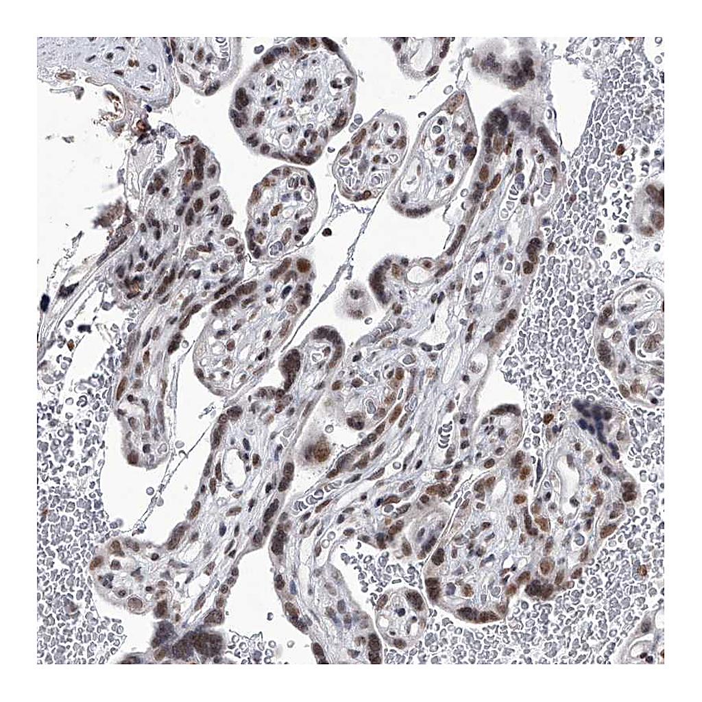 Atlas Antibodies Anti-PPIL4 Antibody