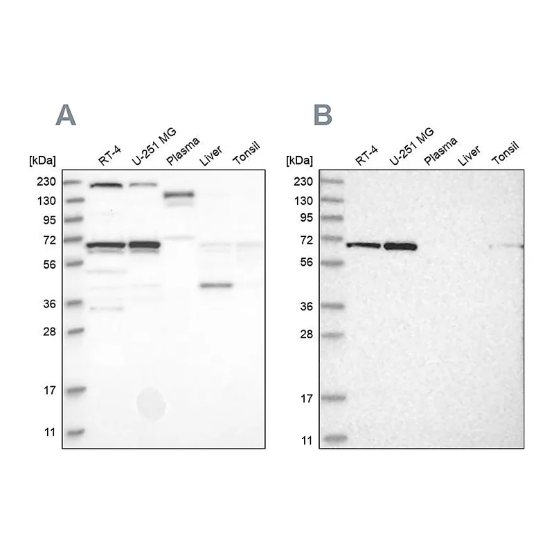 Atlas Antibodies Anti-PPIL4 Antibody