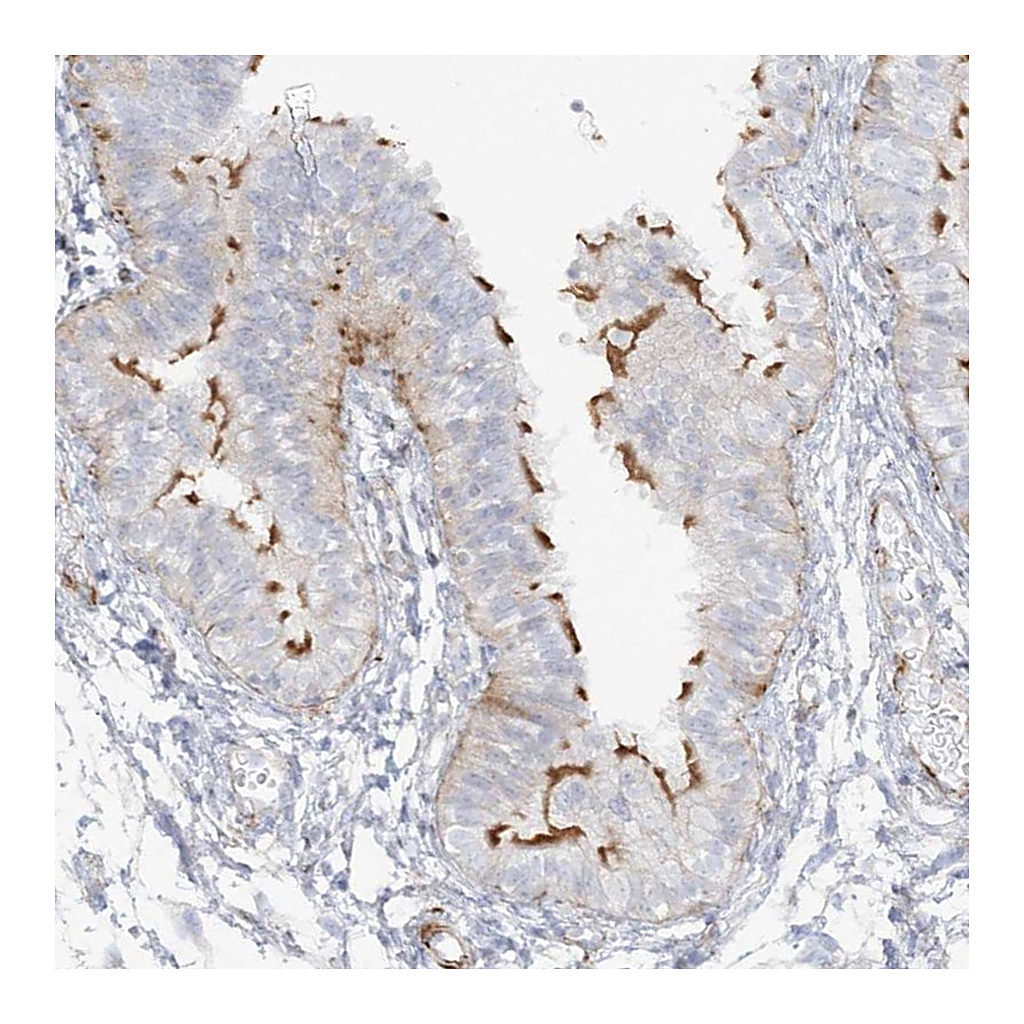 Atlas Antibodies Anti-PPIL6 Antibody